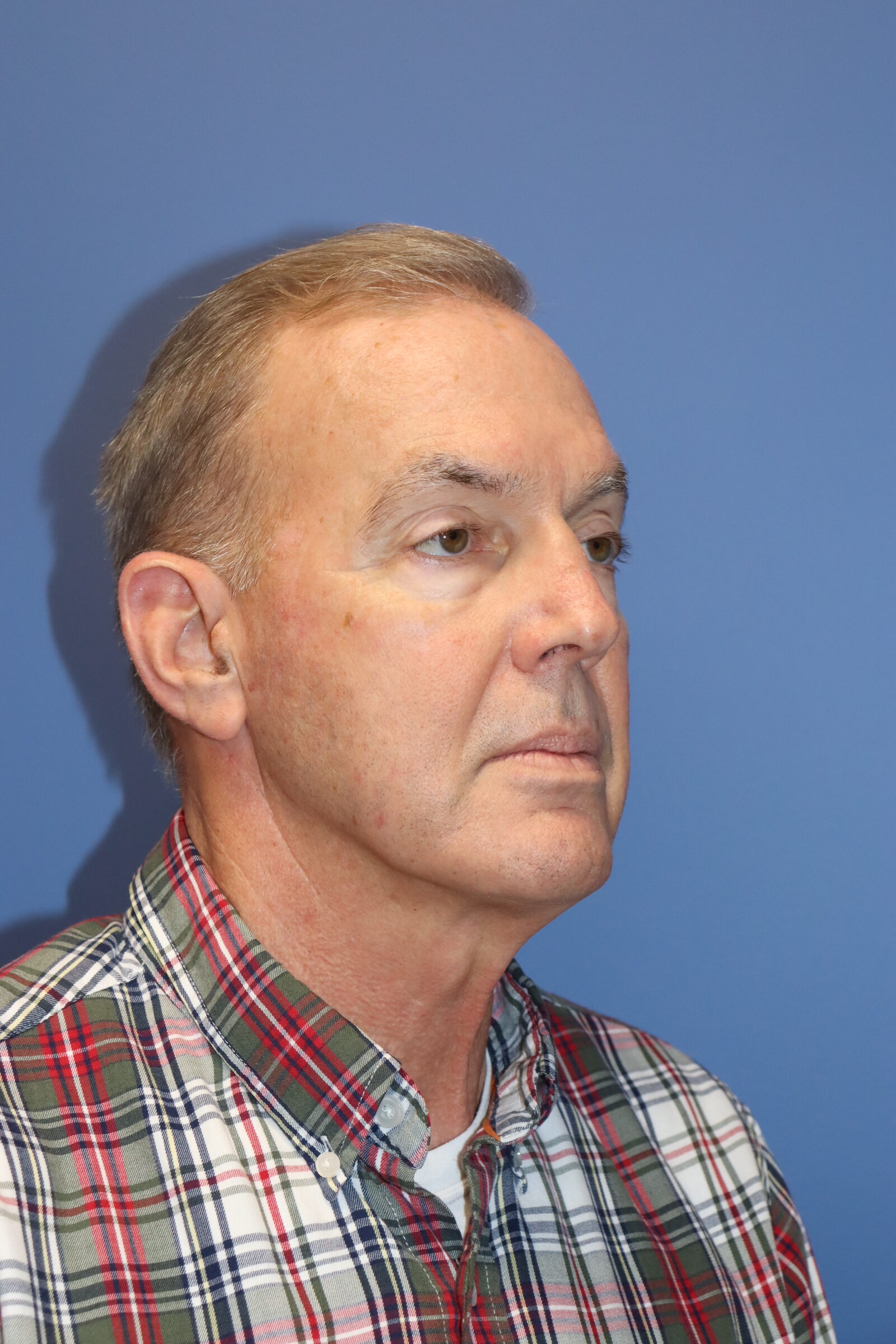 before_A.Berberich_Male_Facelift_RightOblique